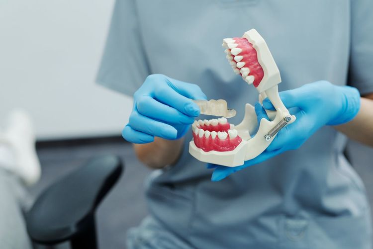 model szczeki w rekach dentysty